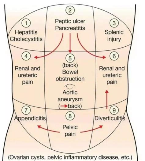 Pelvic Pain Visual Tutorial 